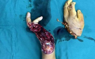 无人机叶割伤人，危险何在？