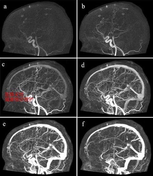 有关人工智能在ct血管-第1张图片-广州国自机器人 有关人工智能在ct血管-第1张图片-广州国自机器人