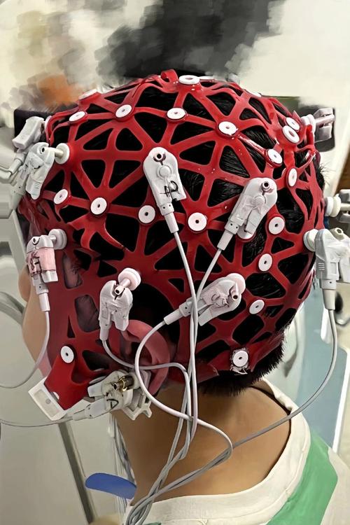 DDoS机器人压力测试如何有效防护？-第3张图片-广州国自机器人