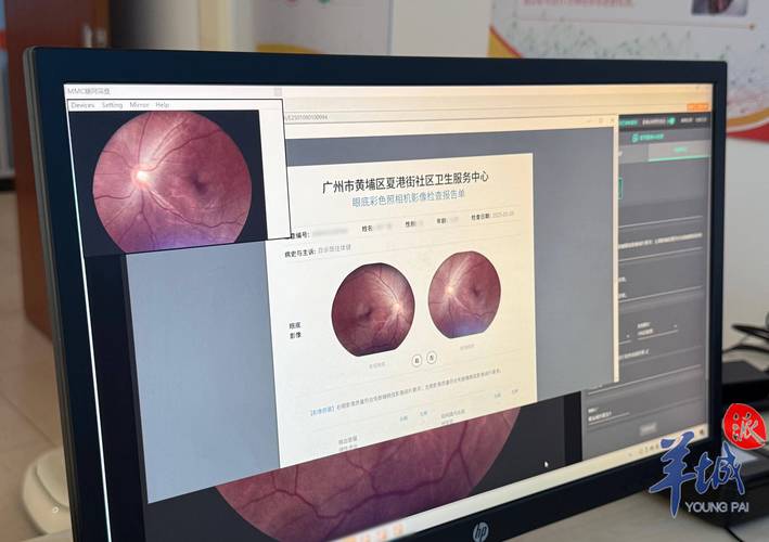 人工智能如何辅助而非主导疾病诊断?-第2张图片-广州国自机器人 人工智能如何辅助而非主导疾病诊断?-第2张图片-广州国自机器人