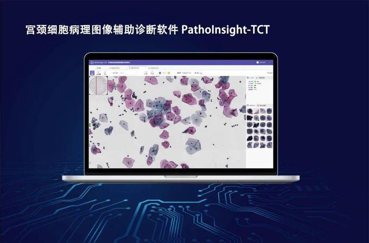 AI如何革新病理切片制片?-第2张图片-广州国自机器人 AI如何革新病理切片制片?-第2张图片-广州国自机器人