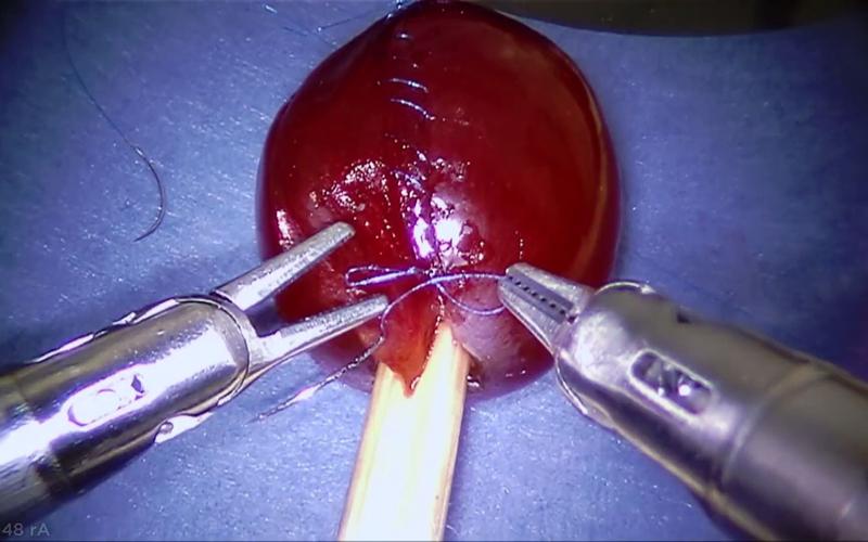 达文西机器人开刀有何优势？-第2张图片-广州国自机器人