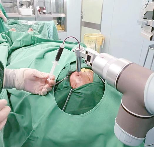 机器人做手术安全吗?-第3张图片-广州国自机器人 机器人做手术安全吗?-第3张图片-广州国自机器人