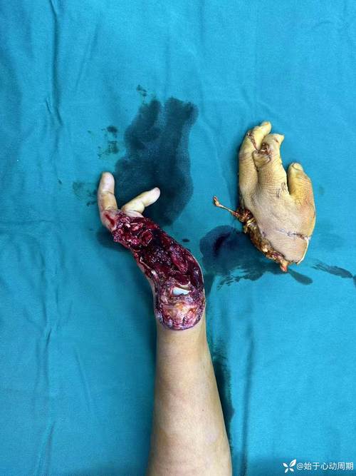 无人机叶割伤人，危险何在？-第1张图片-广州国自机器人