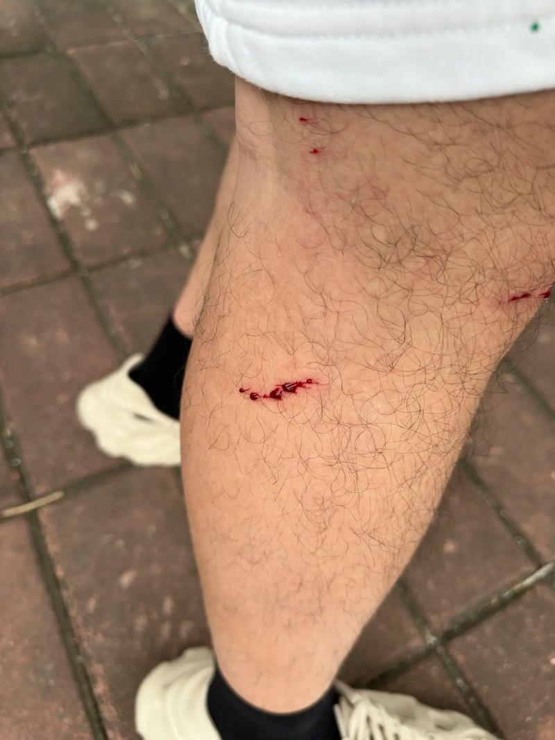 无人机叶割伤人，危险何在？-第2张图片-广州国自机器人