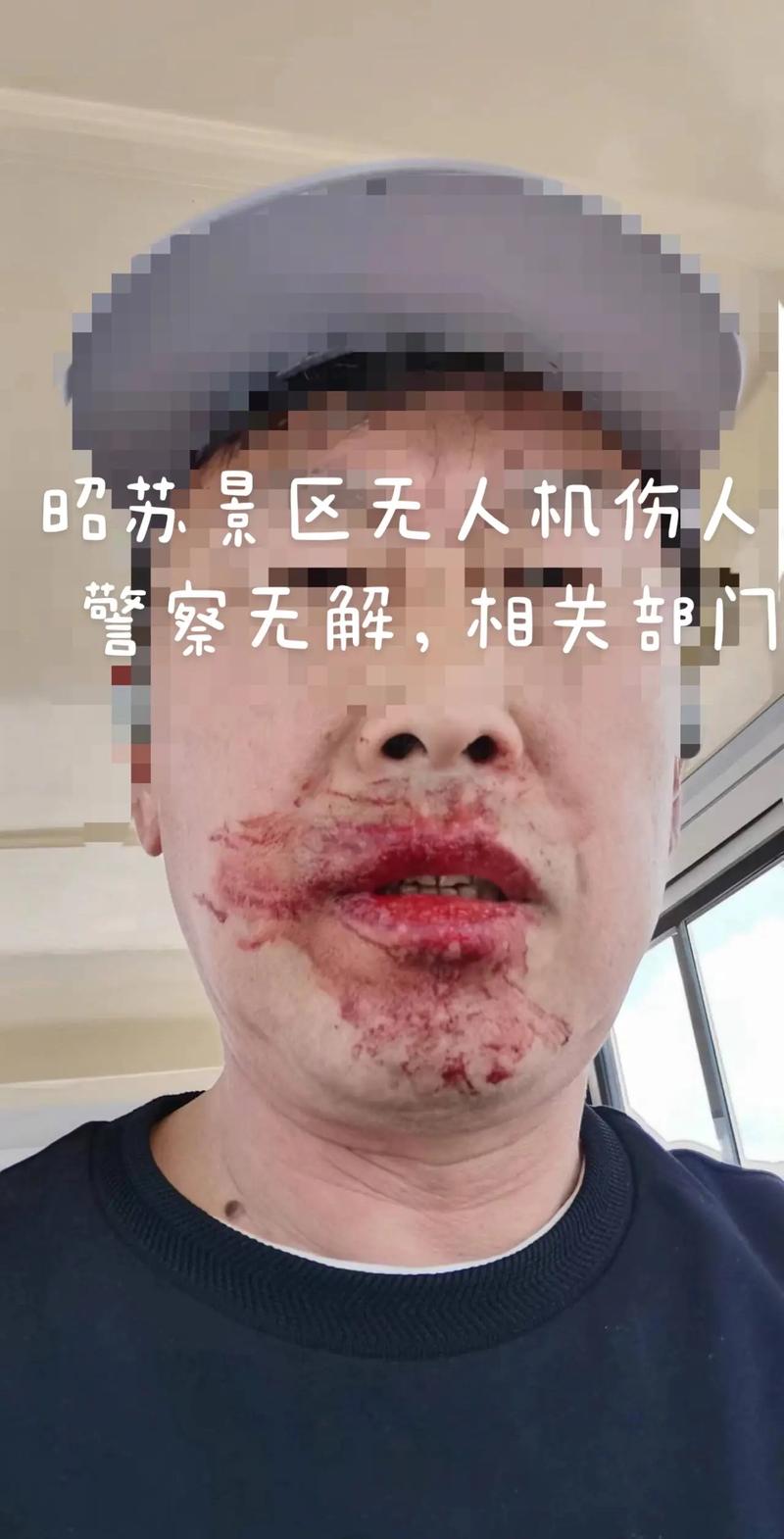 无人机伤人，责任谁来承担？-第3张图片-广州国自机器人