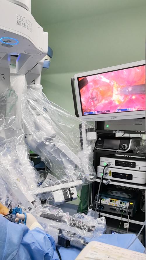 重庆金山手术机器人有何独特优势？-第2张图片-广州国自机器人