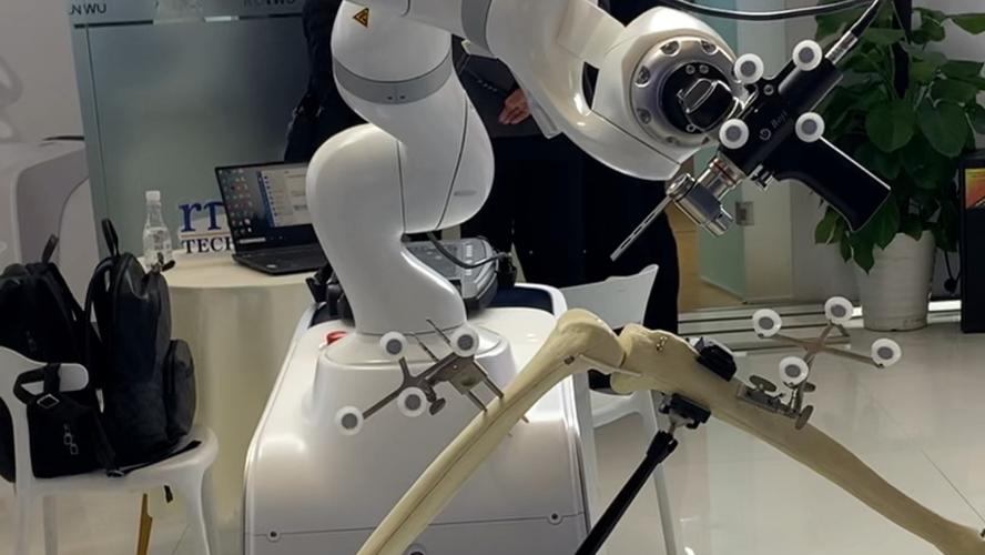 think骨科机器人如何精准助力手术？-第1张图片-广州国自机器人
