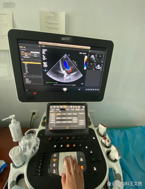 人工智能 超声波影像-第1张图片-广州国自机器人 人工智能 超声波影像-第1张图片-广州国自机器人