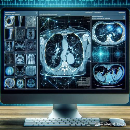 AI医学影像如何赋能精准诊断？-第1张图片-广州国自机器人