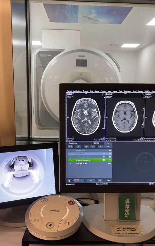 AI医学影像如何赋能精准诊断？-第3张图片-广州国自机器人