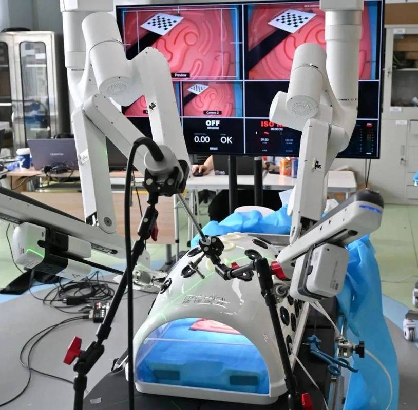 外科人工智能手术设备安全吗？-第2张图片-广州国自机器人