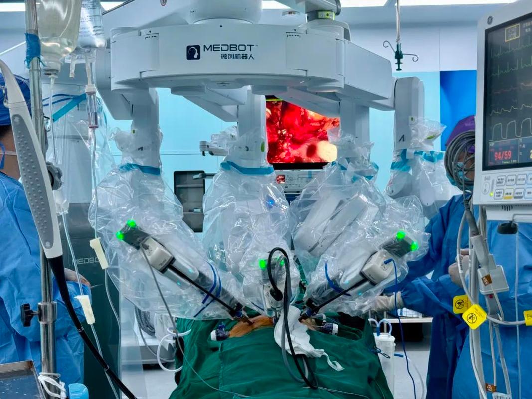 机器人前列腺根除术有何优势？-第3张图片-广州国自机器人